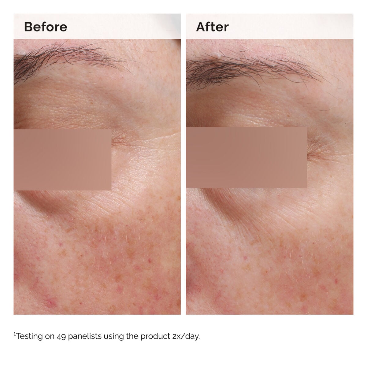 niacinamide-5-face-and-body-emulsion-g4 2024-08-23-ORD-Nia-5pct-Face-Body-B-A-Elasticity-Global-02-1x1.jpg