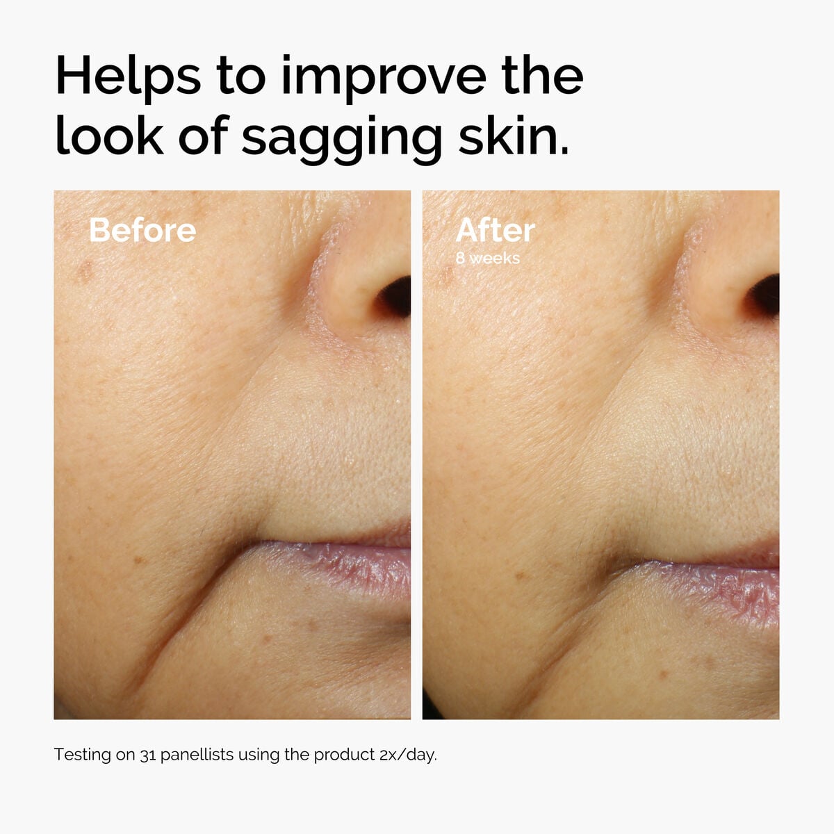 caffeine-3-escin-1-face-serum-i5 ord-caffeine-3pct-escin-1pct-face-serum-before-after-sagging.jpg