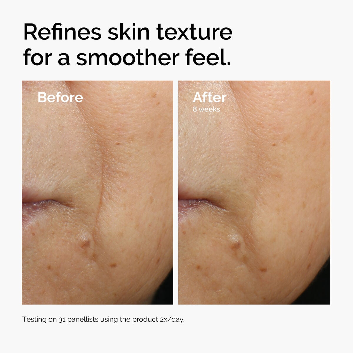 caffeine-3-escin-1-face-serum-i5 ord-caffeine-3pct-escin-1pct-face-serum-before-after-texture.jpg