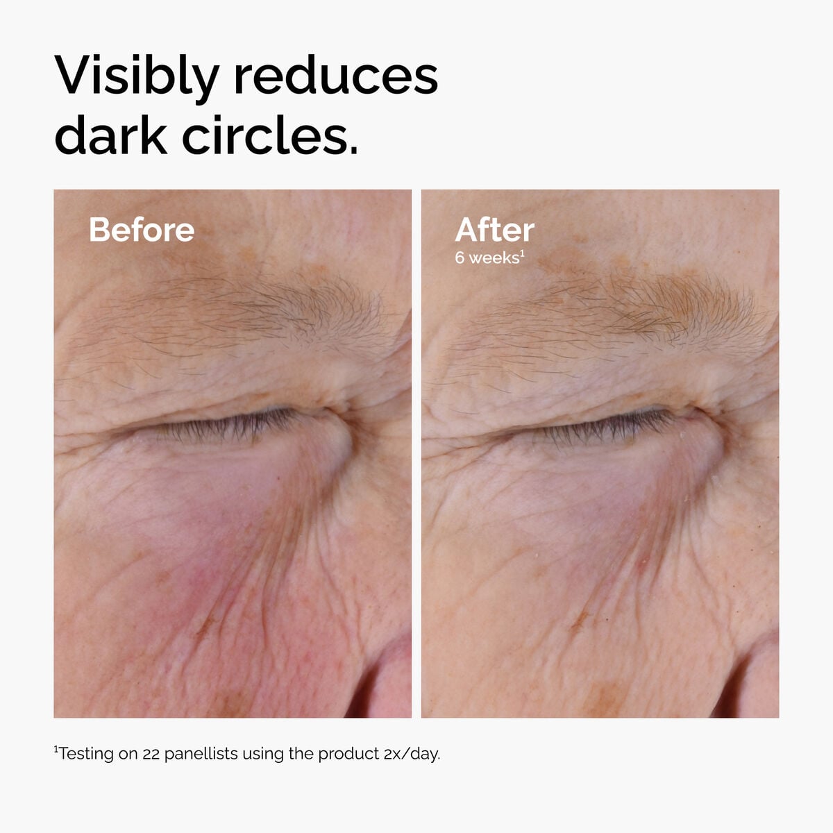 caffeine-solution-5-egcg-eye-serum-x5 ord-caffeine-solution-egcg-dark-circles-before-after.jpg