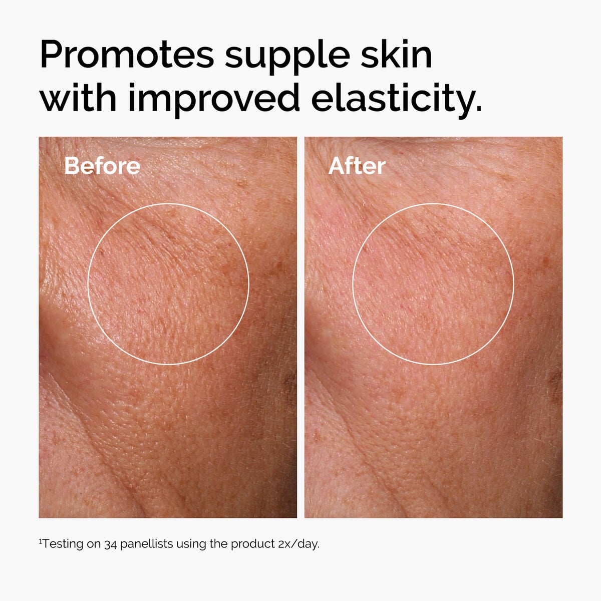 hyaluronic-acid-2-b5-with-ceramides-h3 ord-hyaluronic-acid-2pct-b5-hydrating-serum-before-after-elasticity.jpg