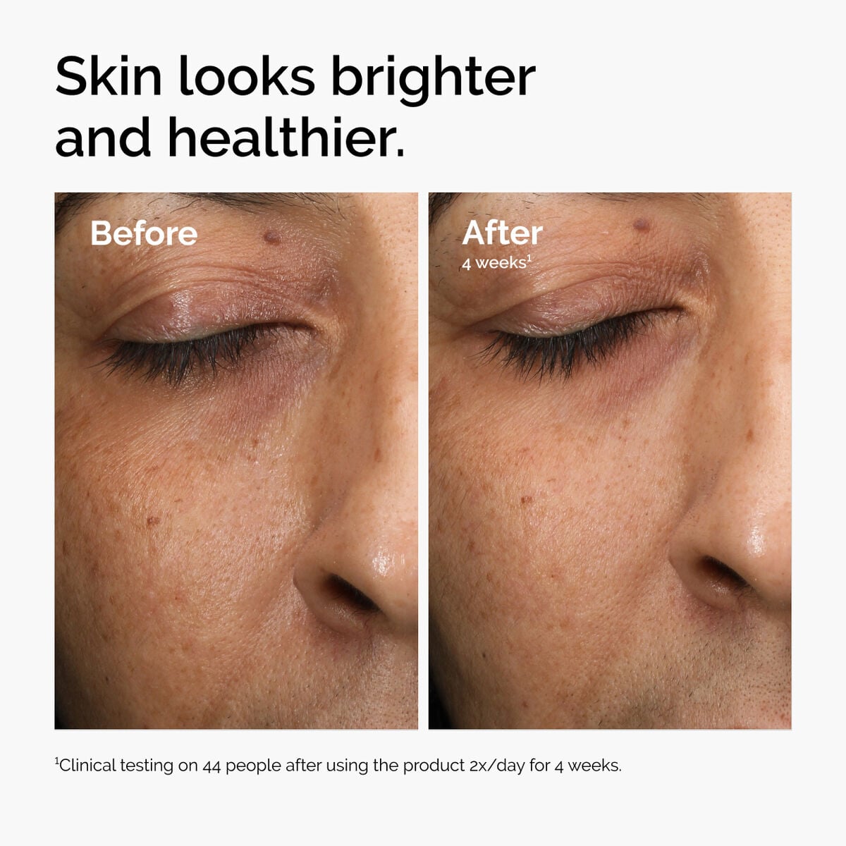 multi-antioxidant-radiance-serum-i8 ord-mars-before-after-healthy.jpg