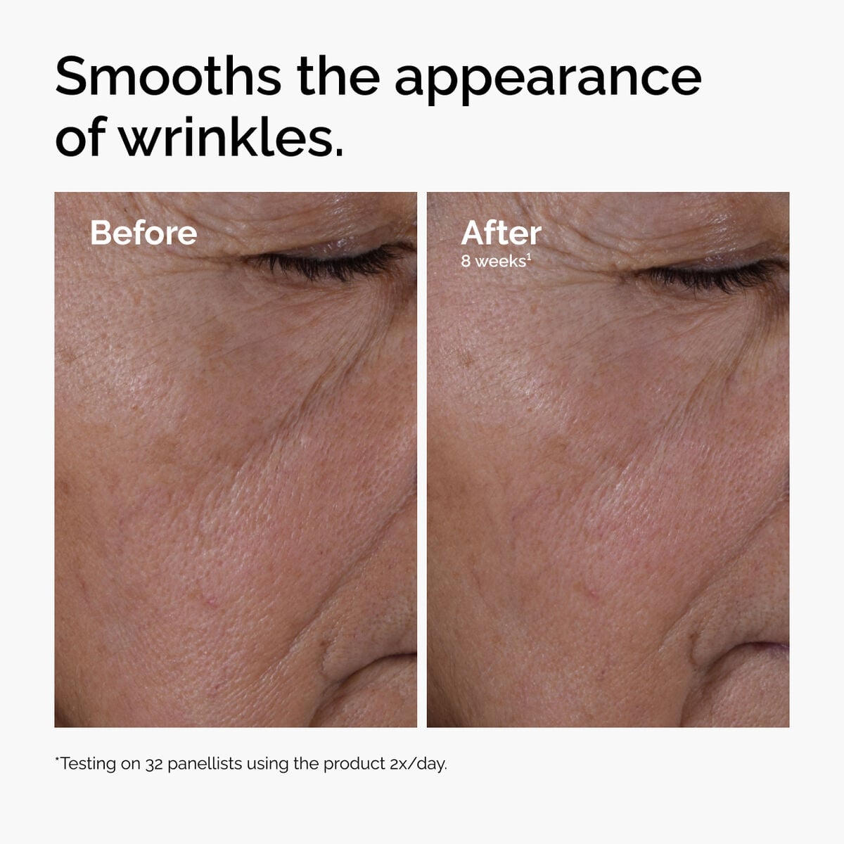 multi-peptide-ha-serum-b9 ord-multi-peptide-ha-serum-wrinkles-before-after.jpg