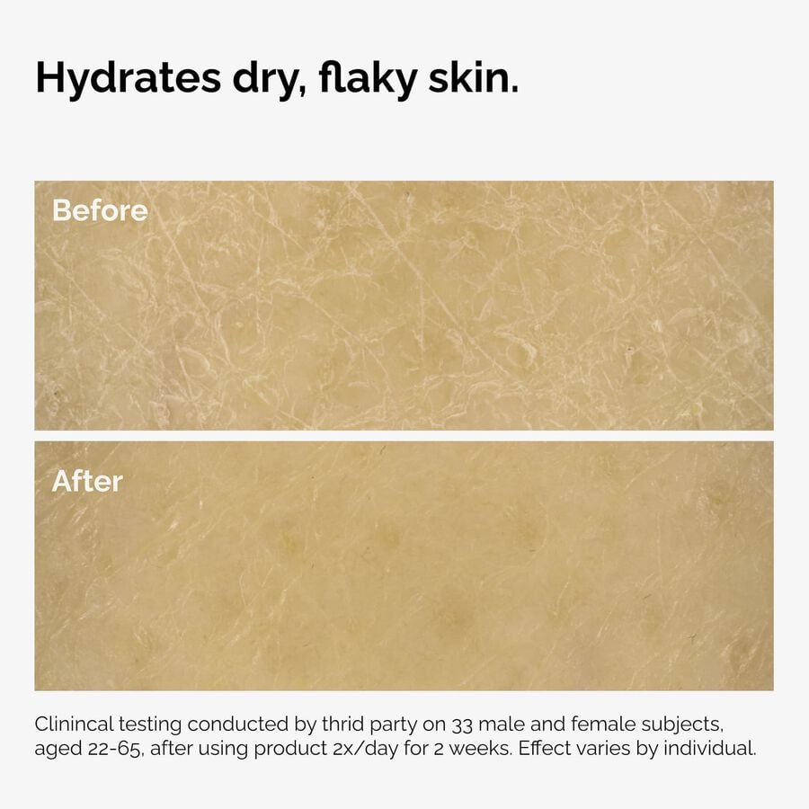 the-body-care-collection-n5 ord-natural-moisturizing-factors-inulin-body-before-after-graphic-02.jpg
