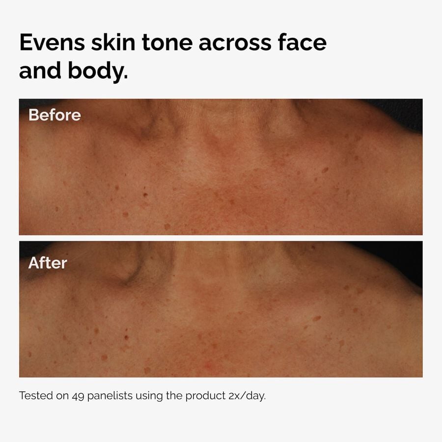 the-body-care-collection-n5 ord-niacinamide-face-body-serum-before-after-even-tone-graphic.jpg