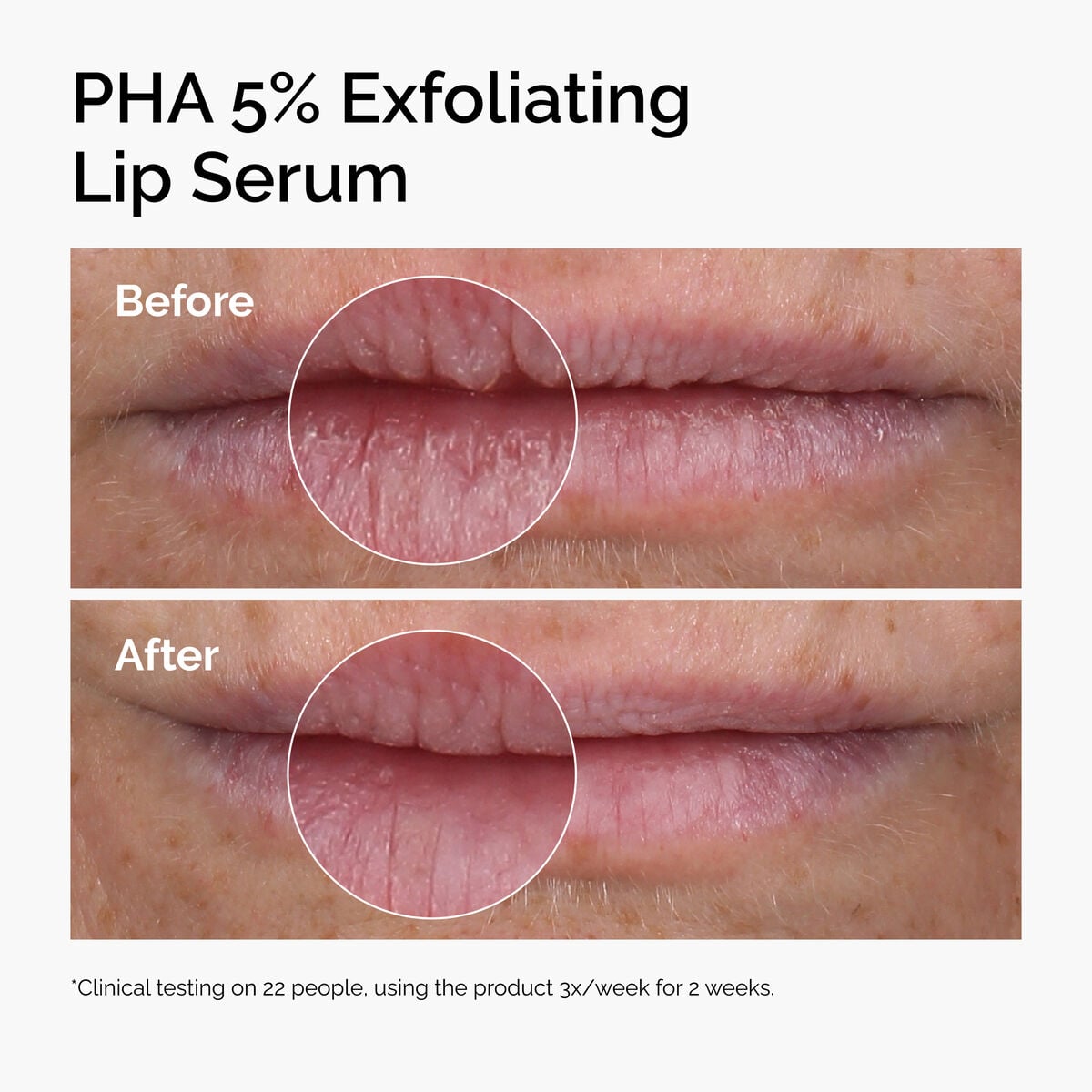 pha-5-exfoliating-lip-serum-g8 ord-pha-5pct-lip-exfoliating-serum-before-after.jpg